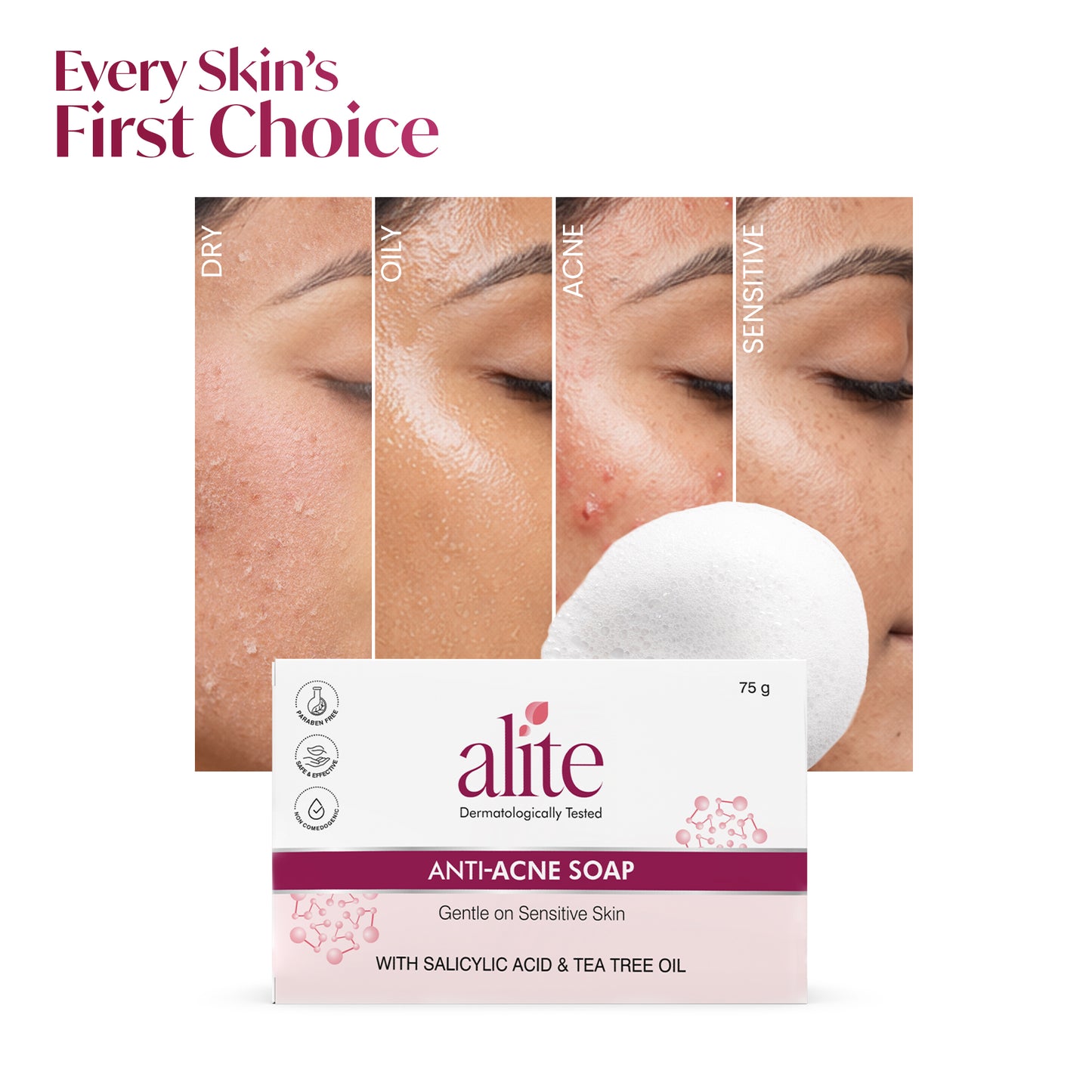 ALITE ANTI ACNE SOAP