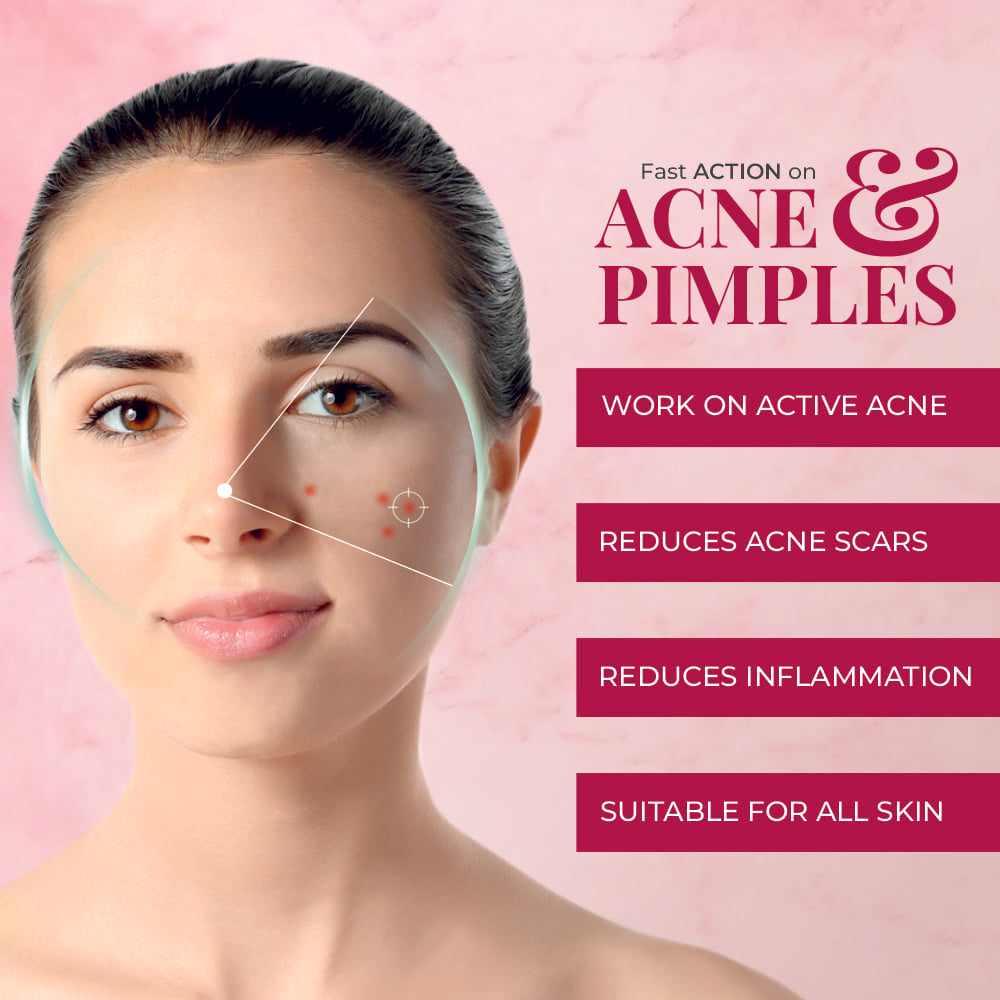 alite-anti-acne-gel-15-g