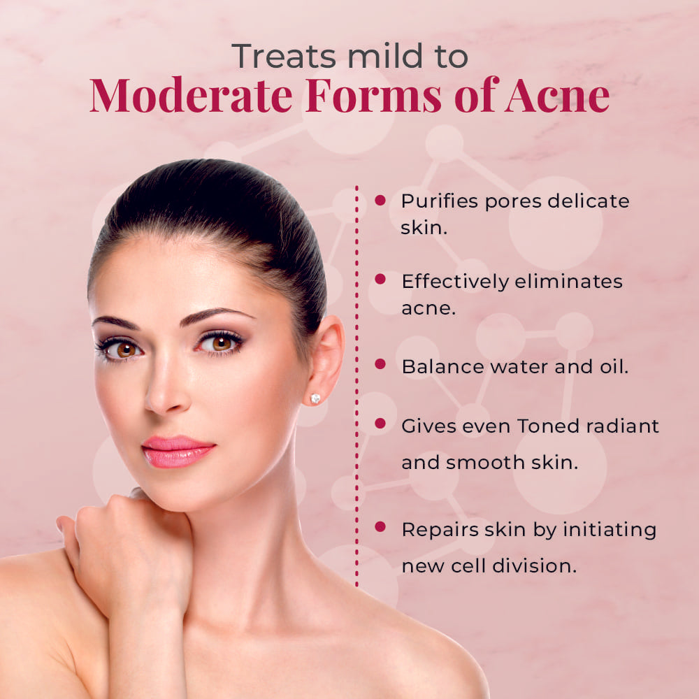 alite-anti-acne-gel-15-g