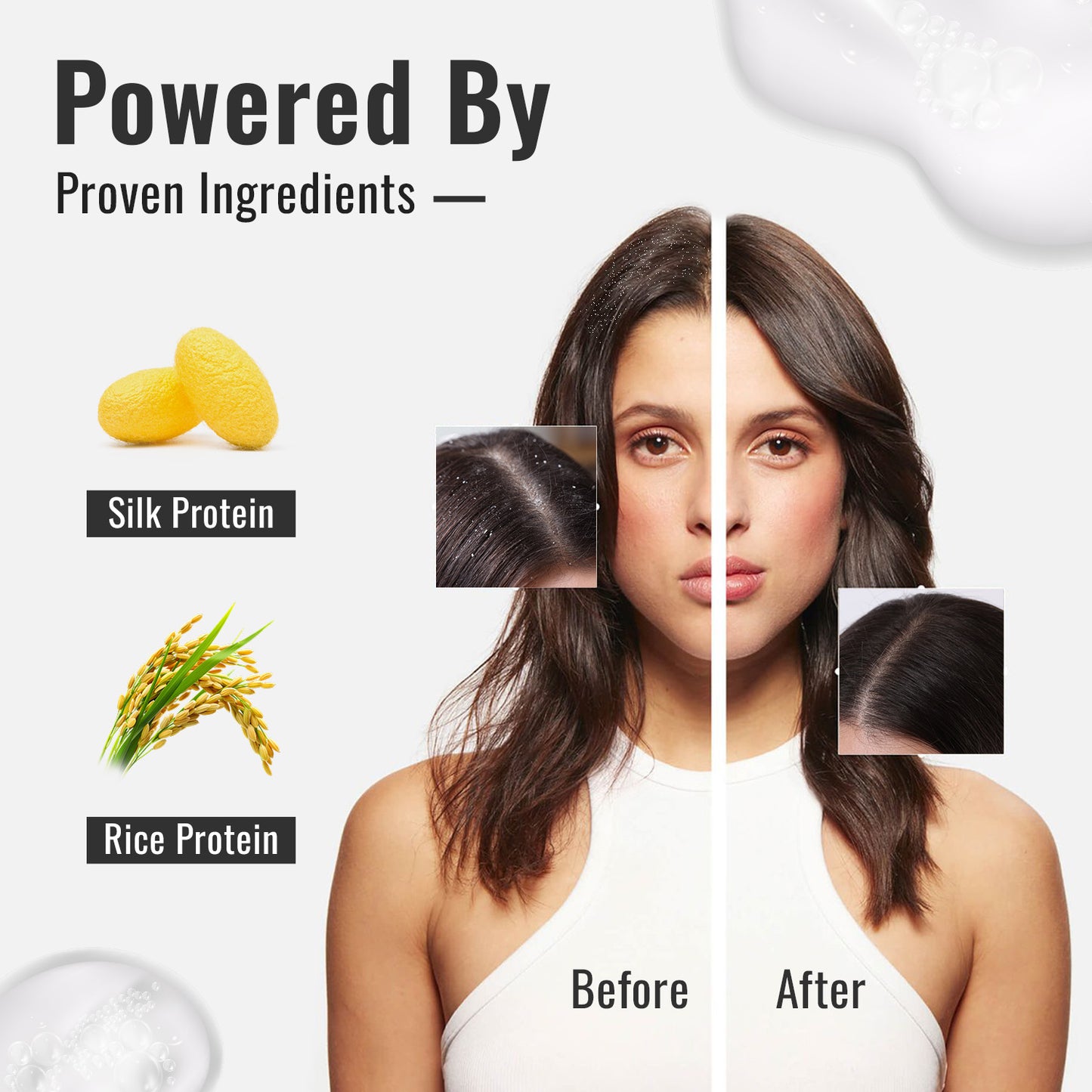 ENSHINE ANTI DANDRUFF SHAMPOO 225 ml