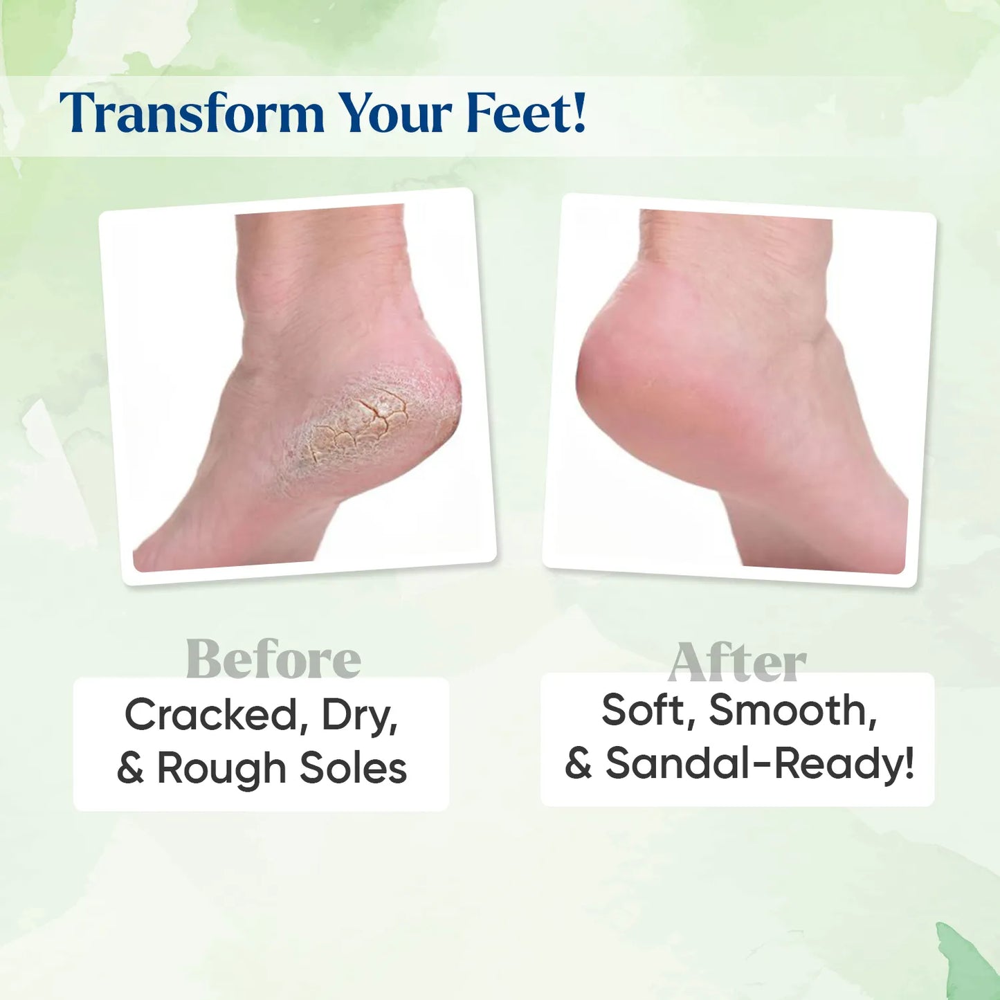 SOFT SOLES CREAM 30G