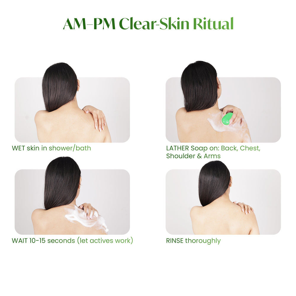 ALITE NEEM & ALOEVERA SOAP