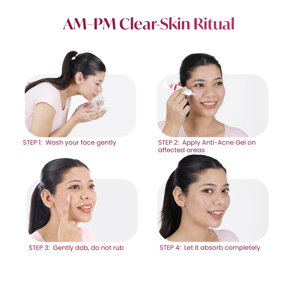 ALITE ANTI ACNE GEL