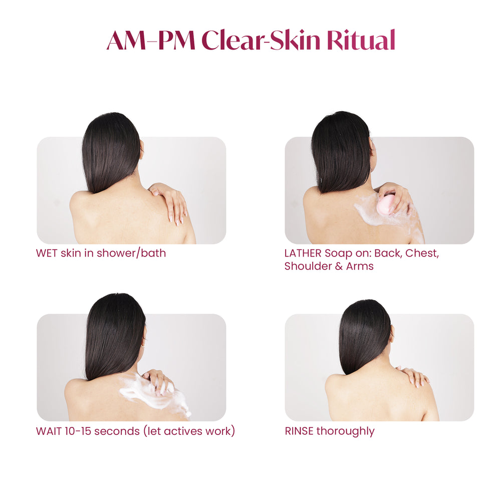 ALITE ANTI ACNE SOAP