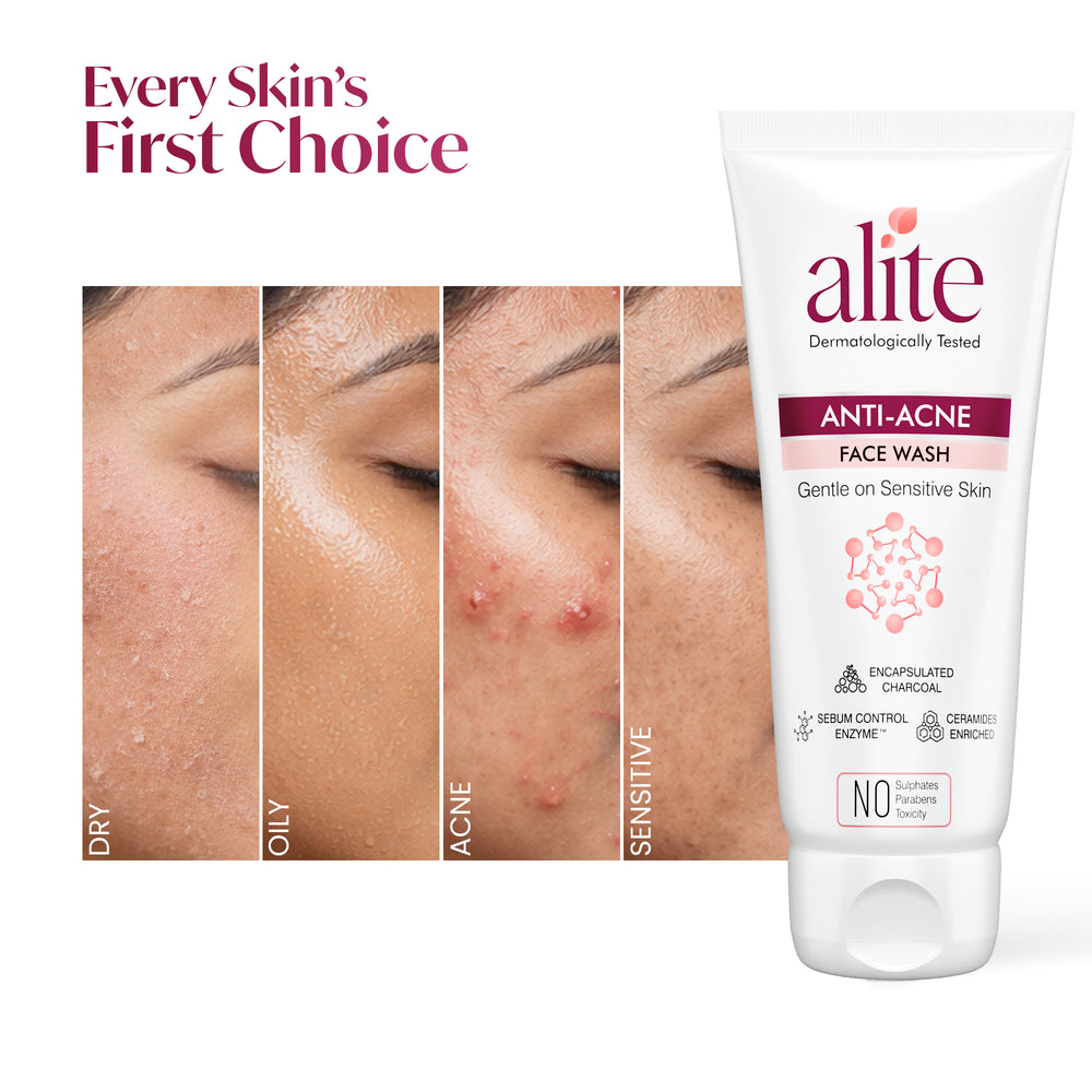 ALITE ANTI ACNE FACE WASH