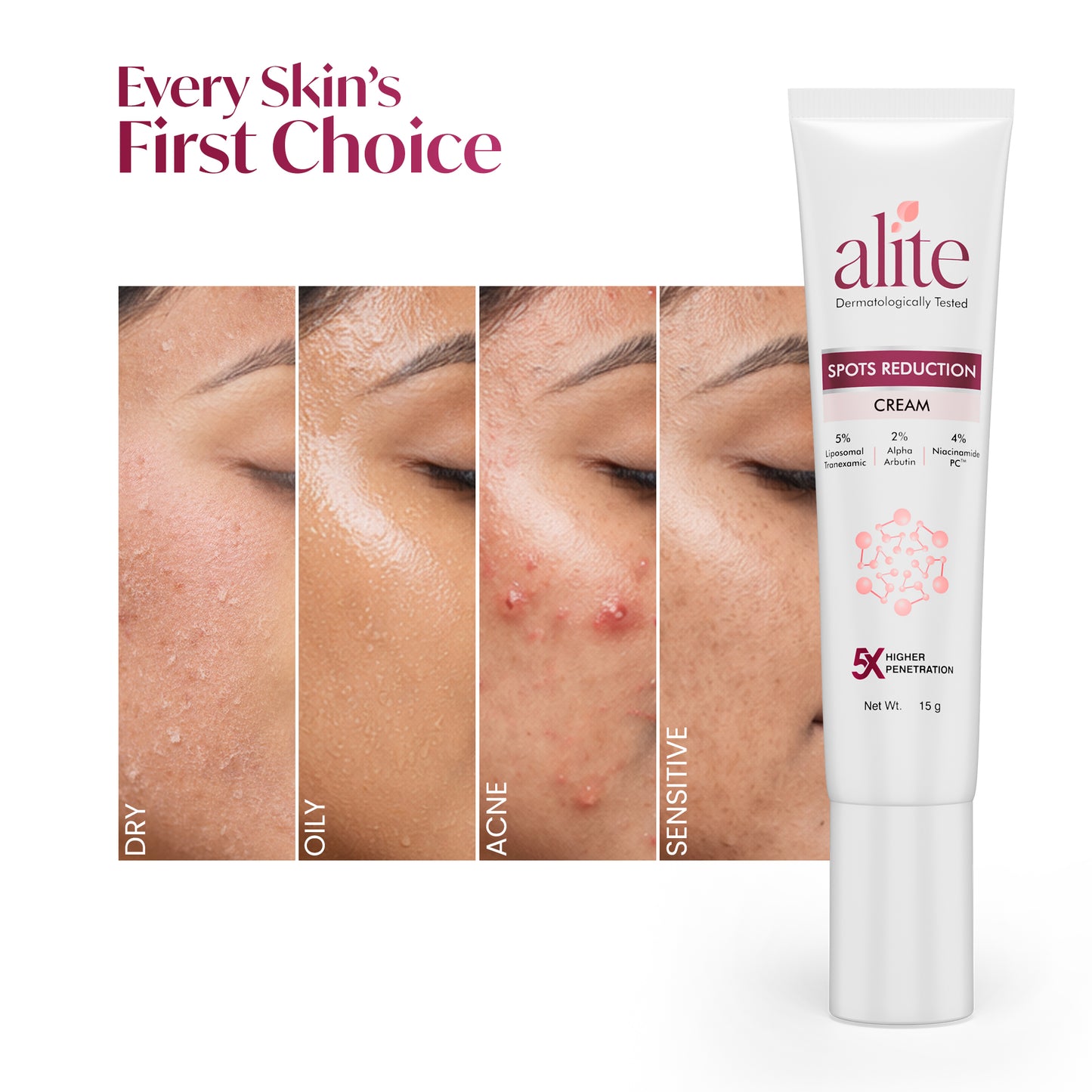 ALITE SPOT REDUCTION CREAM