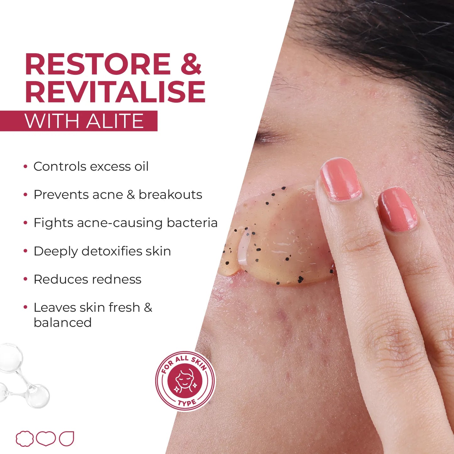 ALITE ANTI ACNE FACE WASH 70 GM