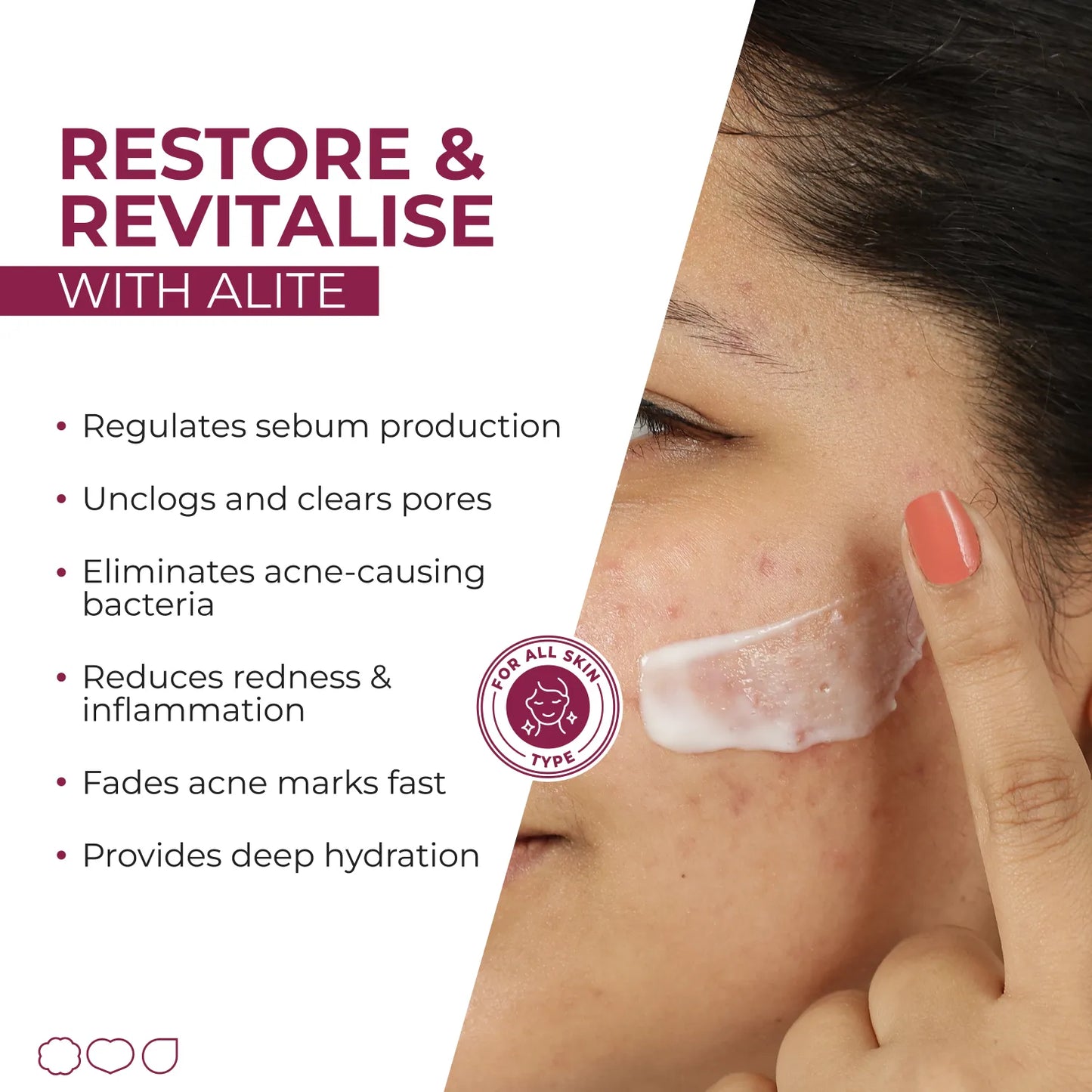 ALITE SPOT REDUCTION CREAM