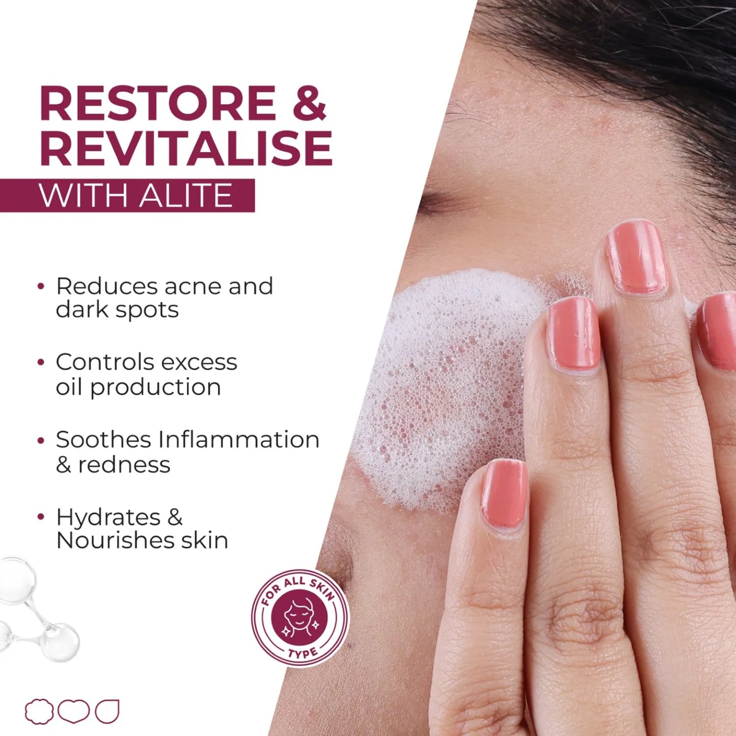 ALITE ANTI ACNE SOAP