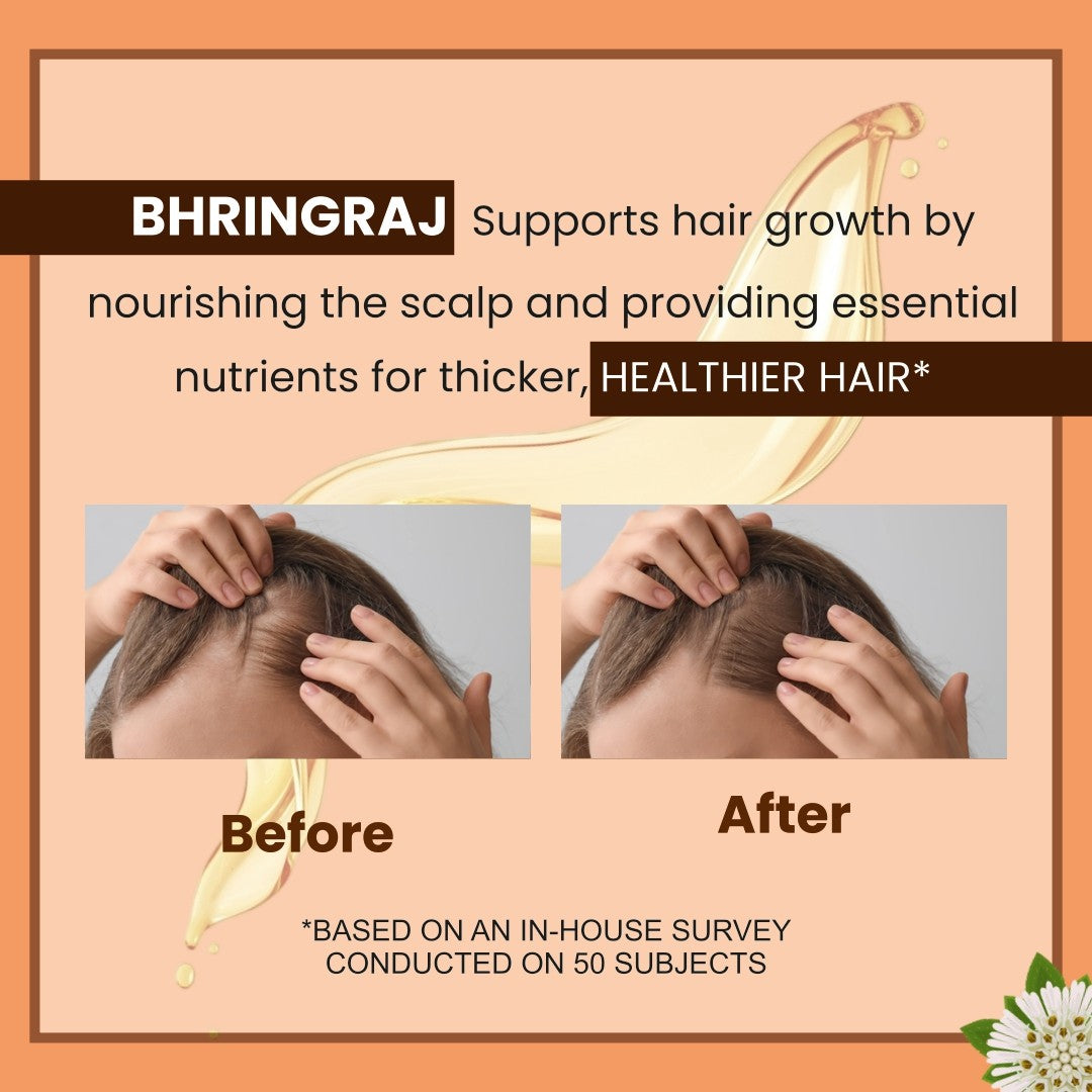 enshine-anti-dandruff-oil-60-ml